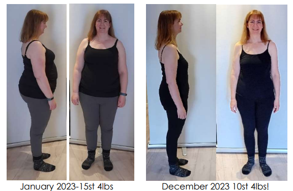 virtual gastric band client before and after weight loss